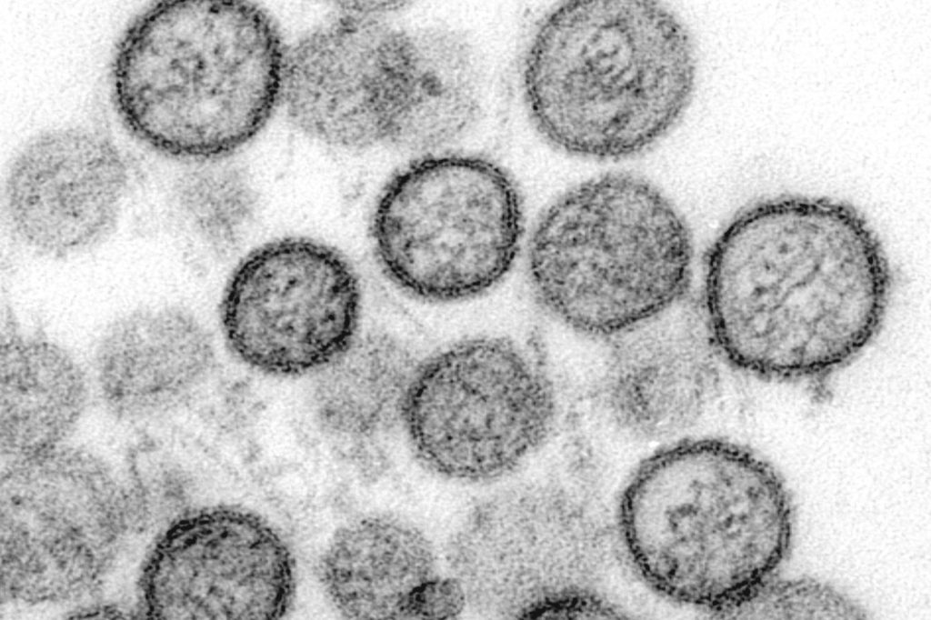 Another pandemic? Fears grow as China reports case of Hantavirus
